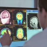 A healthcare provider reviewing brain CT scan images